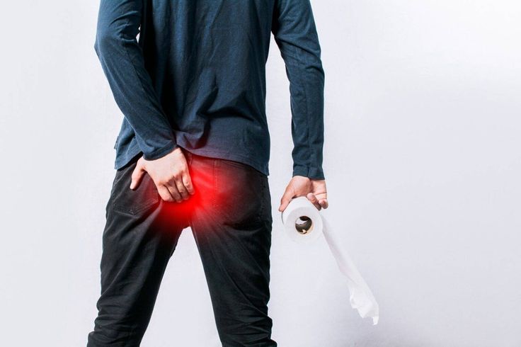 Fissure & Fistula Treatment